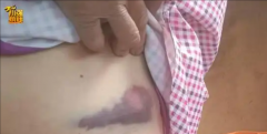 女子上班路上被大狼狗扑咬，血肉模糊！